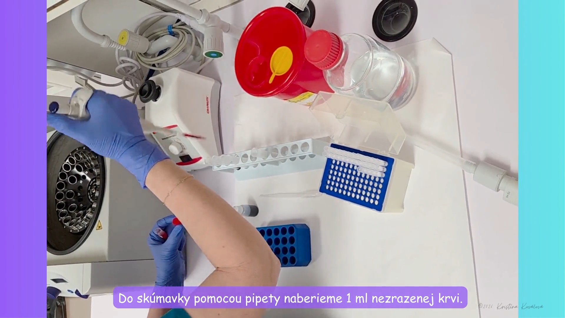 Modifikovaný Knottov Test